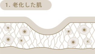 1.老化した肌