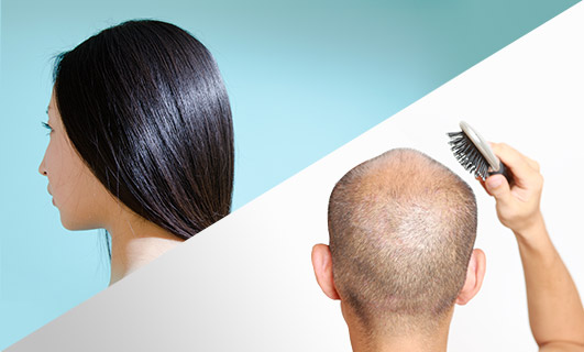 さまざまな原因でおこる薄毛・抜け毛を、育毛を促すサイトカインが含まれた幹細胞セクレトームエキスを使って治療します。