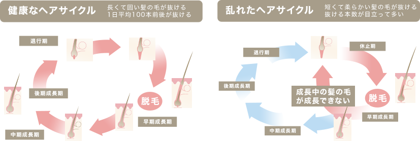 健康なヘアサイクル 乱れたヘアサイクル