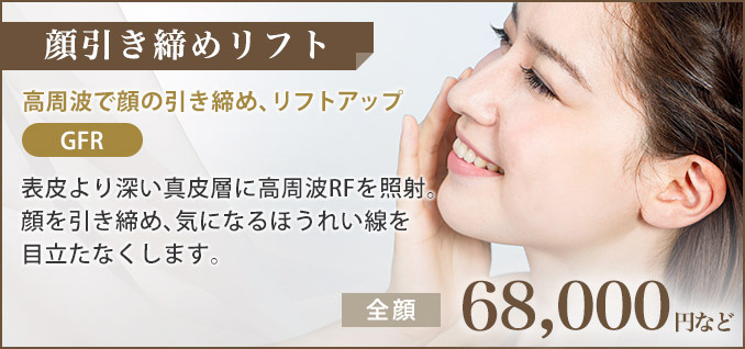 顔引き締めリフト