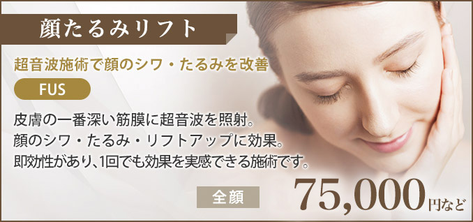 顔たるみリフト