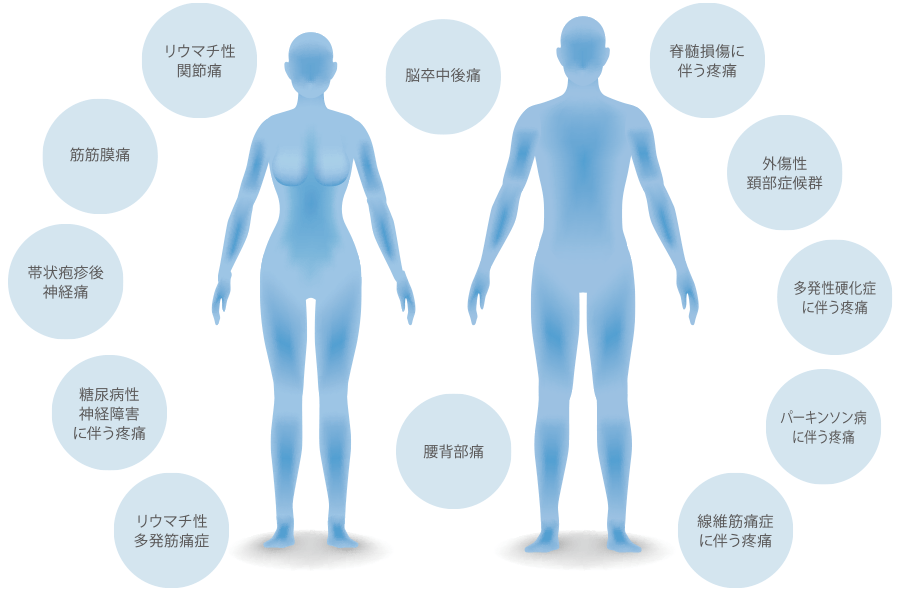 慢性疼痛の適応症