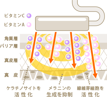 イオン導入