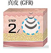 イントラジェン（GFR）